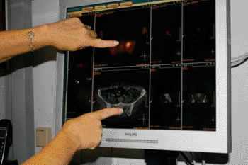 Image: Evaluating the scan (Photo courtesy of John Brooks).